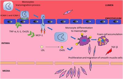 Novel Insights in Systemic Lupus Erythematosus and Atherosclerosis